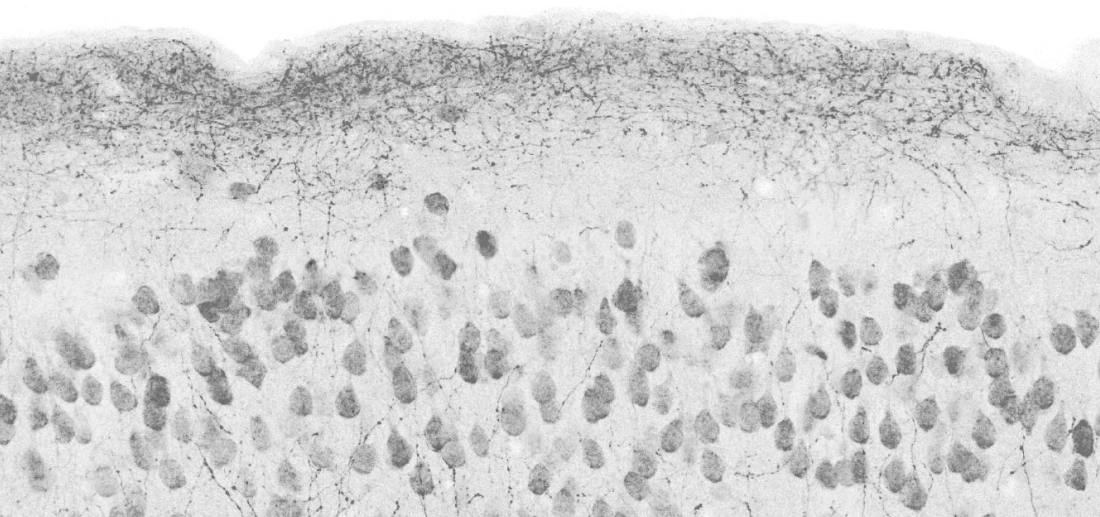 Top-down afferents to neocortical layer 1